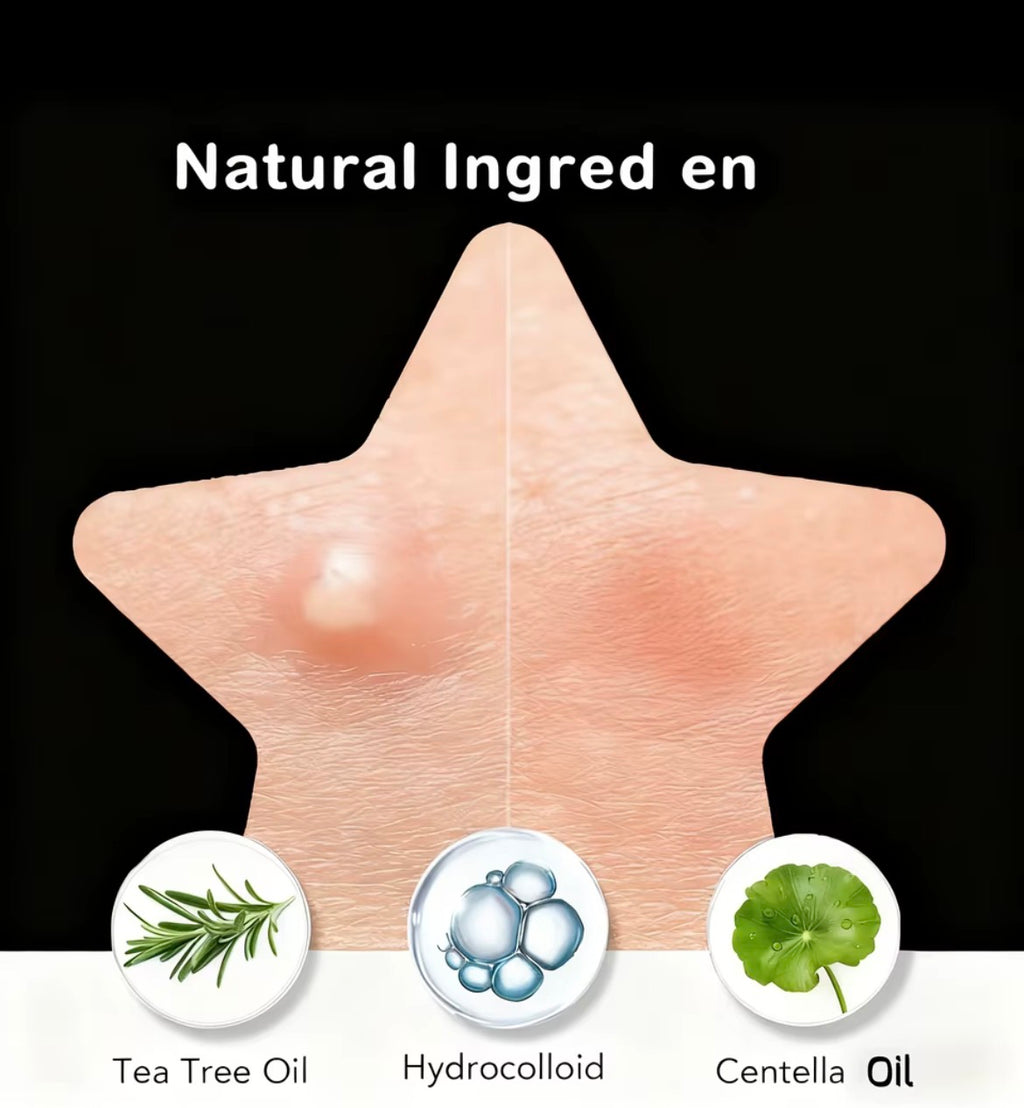 Bulk Pack Black Star Shaped Hydrocolloid Pimple Patches