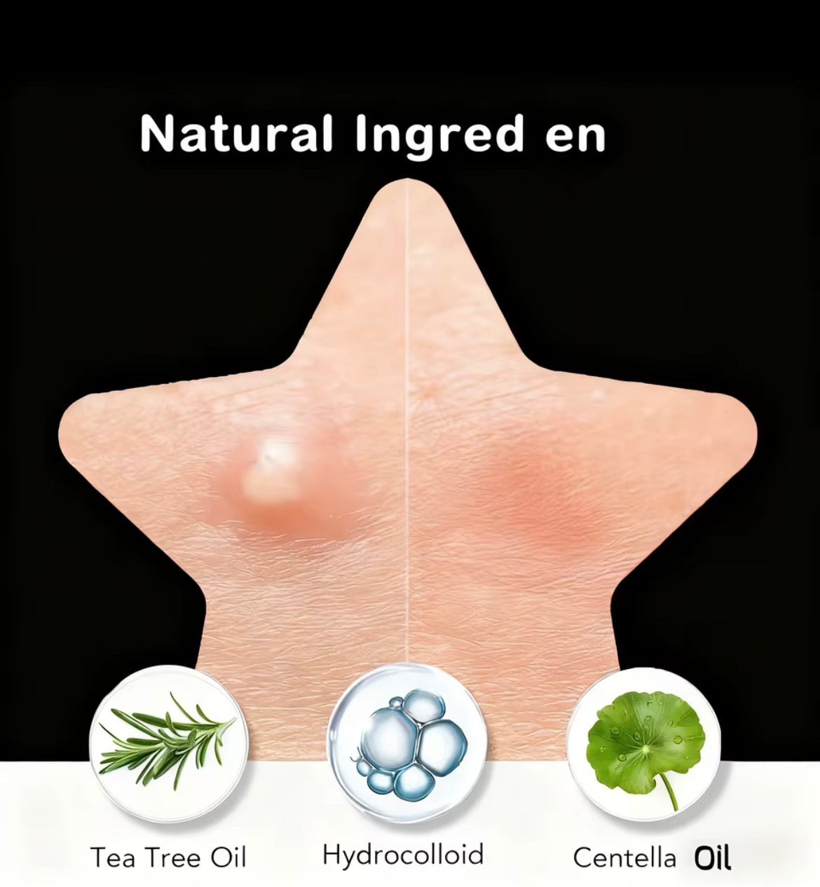 Bulk Pack Black Star Shaped Hydrocolloid Pimple Patches
